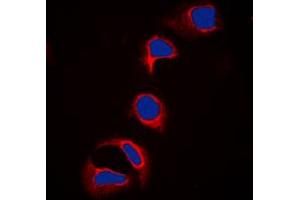 Immunofluorescent analysis of c-CBL (pY700) staining in HeLa cells. (CBL 抗体  (C-Term, pTyr700))