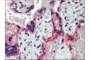 Human Placenta: Formalin-Fixed, Paraffin-Embedded (FFPE) (MMP3 抗体  (Ser373))