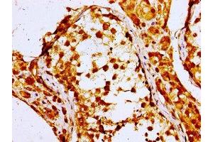 Immunohistochemistry of paraffin-embedded human testis tissue using ABIN7161727 at dilution of 1:100 (NPC1 抗体  (AA 23-269))