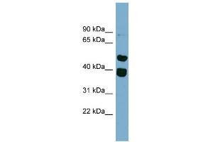 WB Suggested Anti-TRIM49 Antibody Titration: 0. (TRIM49 抗体  (Middle Region))