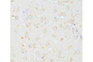 Immunohistochemistry of paraffin-embedded Mouse brain using CHRNA7 Polyclonal Antibody at dilution of 1:100 (40x lens). (CHRNA7 抗体)