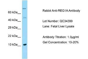 Host: Rabbit Target Name: REG1A Sample Type: Fetal Liver Antibody Dilution: 1. (REG1A 抗体  (C-Term))