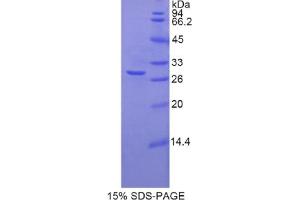 SDS-PAGE analysis of Rat TNNT1 Protein. (TNNT1 蛋白)