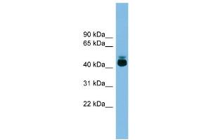 WB Suggested Anti-GPR87 Antibody Titration: 0. (GPR87 抗体  (Middle Region))