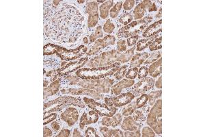 Immunohistochemical analysis of (ABIN656404 and ABIN2845698) on paraffin-embedded Human kidney tissue.