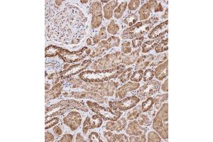 Immunohistochemical analysis of (ABIN656404 and ABIN2845698) on paraffin-embedded Human kidney tissue. (WFDC1 抗体  (C-Term))