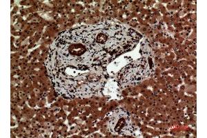 Immunohistochemistry (IHC) analysis of paraffin-embedded Human Liver, antibody was diluted at 1:100. (IL12A 抗体  (Internal Region))