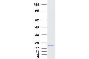 Western Blotting (WB) image for Magnesium-Dependent Phosphatase 1 (MDP1) protein (Myc-DYKDDDDK Tag) (ABIN2725718)