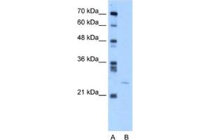 Western Blotting (WB) image for anti-YEATS Domain Containing 4 antibody (ABIN2460178) (GAS41 抗体)