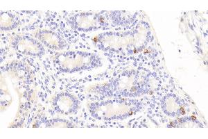 Detection of CTGF in Human Small intestine Tissue using Polyclonal Antibody to Connective Tissue Growth Factor (CTGF) (CTGF 抗体  (AA 248-349))