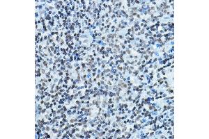 Immunohistochemistry of paraffin-embedded rat spleen using K Rabbit pAb (ABIN6128005, ABIN6142689, ABIN6142690 and ABIN6221516) at dilution of 1:100 (40x lens). (MYST2 抗体  (AA 55-193))