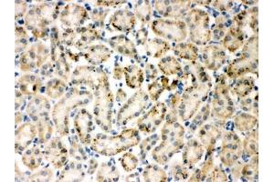 IHC-P testing of TIMP4 antibody and rat kidney tissue (TIMP4 抗体  (AA 208-224))