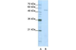 WB Suggested Anti-SARS Antibody Titration:  1. (Seryl-tRNA Synthetase (SARS) (Middle Region) 抗体)