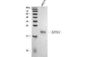 Western blot analysis of SIVA/SIVA1 using anti-SIVA/SIVA1 antibody (ABIN7598994).