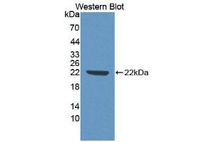 Western blot analysis of the recombinant protein. (ECT2 抗体  (AA 166-348))