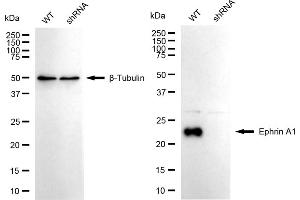 anti-Ephrin A1 (EFNA1) antibody
