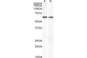 ABIN185382 (2µg/ml) staining of Human Thymus (A) and Human Lymph node (B) lysates (35µg protein in RIPA buffer). (PPP2R1A 抗体  (C-Term))