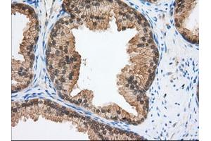 Immunohistochemistry (IHC) image for anti-Transforming, Acidic Coiled-Coil Containing Protein 3 (TACC3) antibody (ABIN1498098) (TACC3 抗体)