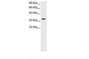 Image no. 2 for anti-PRKC, Apoptosis, WT1, Regulator (PAWR) (AA 212-261) antibody (ABIN202286) (PAWR 抗体  (AA 212-261))