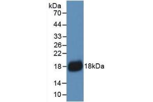 Detection of Recombinant IL18, Human using Monoclonal Antibody to Interleukin 18 (IL18) (IL-18 抗体  (AA 37-193))