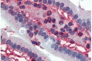 Immunohistochemistry (Formalin-fixed Paraffin-embedded Sections) (IHC (fp)) image for anti-Cyclin-Dependent Kinase 1 (CDK1) antibody (ABIN462412)