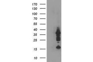 Western Blotting (WB) image for anti-PDZ and LIM Domain 2 (PDLIM2) antibody (ABIN1500123) (PDLIM2 抗体)