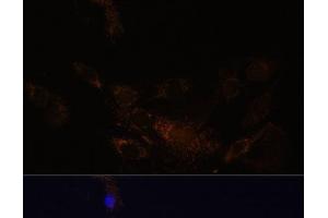 Immunofluorescence analysis of C6 cells using PSMB7 Polyclonal Antibody at dilution of 1:100 (40x lens).