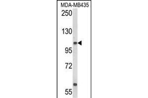 Western blot analysis of CASD1 Antibody (N-term) (ABIN652803 and ABIN2842526) in MDA-M cell line lysates (35 μg/lane). (CASD1 抗体  (N-Term))