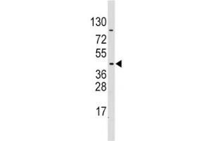 Western blot analysis of PDK4 antibody and CEM lysate (PDK4 抗体  (AA 250-277))