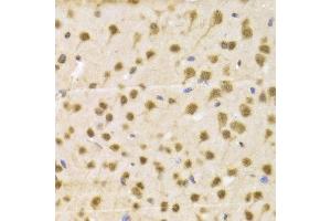 Immunohistochemistry of paraffin-embedded Mouse brain using RBFOX3 antibody at dilution of 1:100 (x400 lens). (NeuN 抗体)