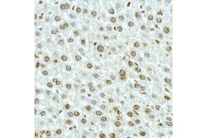 Immunohistochemistry of paraffin-embedded rat brain using NOP10 Rabbit mAb (ABIN7268953) at dilution of 1:50 (40x lens).