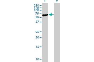 Western Blot analysis of STK40 expression in transfected 293T cell line by STK40 MaxPab polyclonal antibody. (STK40 抗体  (AA 1-435))