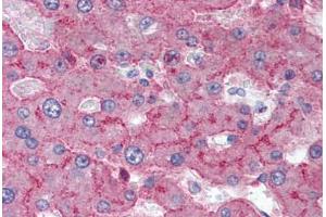 Human Liver (formalin-fixed, paraffin-embedded) stained with LRP1 antibody ABIN337070 at 5-10 ug/ml followed by biotinylated anti-mouse IgG secondary antibody ABIN481714, alkaline phosphatase-streptavidin and chromogen. (LRP1 抗体)