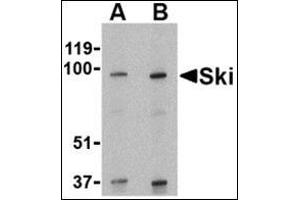 Western blot analysis of Ski in human kidney tissue lysate with this product at (A) 1 and (B) 2 μg/ml. (SKI 抗体  (N-Term))