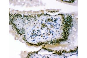 IHC analysis of p95 NBS1 using anti-p95 NBS1 antibody (ABIN3043282). (Nibrin 抗体  (C-Term))