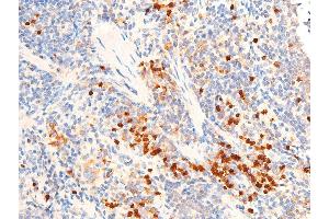 ABIN6267067 at 1/100 staining mouse spleen tissue sections by IHC-P. (TGFB1 抗体  (C-Term))