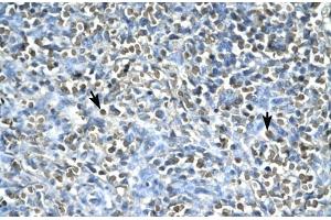 Human Spleen; ASGR2 antibody - N-terminal region in Human Spleen cells using Immunohistochemistry (Asialoglycoprotein Receptor 2 抗体  (N-Term))