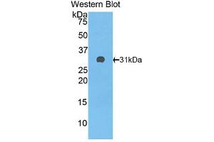 Western blot analysis of the recombinant protein. (Complement Factor H 抗体  (AA 915-1156))