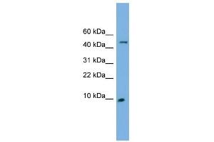 ENSA antibody used at 1 ug/ml to detect target protein. (Ensa 抗体  (N-Term))