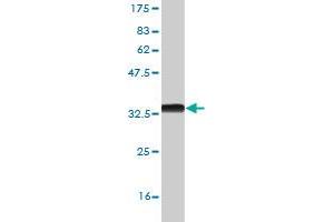 Western Blotting (WB) image for anti-Zic Family Member 4 (ZIC4) (AA 249-319) antibody (ABIN529567)