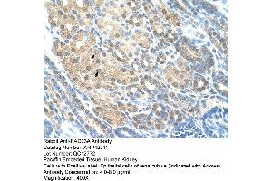 Rabbit Anti-RAD23A Antibody  Paraffin Embedded Tissue: Human Kidney Cellular Data: Epithelial cells of renal tubule Antibody Concentration: 4. (RAD23A 抗体  (Middle Region))