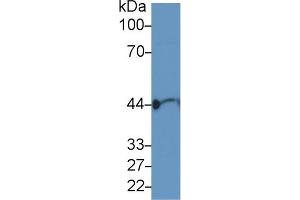 Detection of ACTG in Human Serum using Polyclonal Antibody to Gamma Actin (ACTG) (Actin, gamma 1 抗体  (AA 1-375))