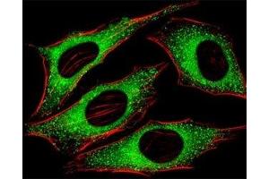 Fluorescent image of HeLa cells stained with FGFR2 antibody at 1:25 dilution. (FGFR2 抗体  (AA 7-37))