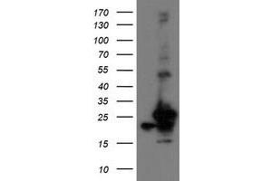 Image no. 8 for anti-Prefoldin Subunit 3 (PFDN3) antibody (ABIN1501704)