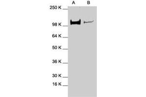Western blot analysis of STAT2 polyclonal antibody  in expression in A-431 (A) and HeLa (B) whole cell lysates. (STAT2 抗体  (C-Term))