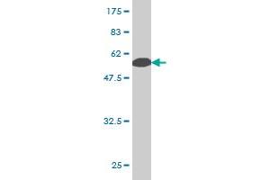 Western Blot detection against Immunogen (65. (PCBP2 抗体  (AA 1-362))