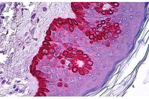 Human Skin: Formalin-Fixed, Paraffin-Embedded (FFPE) (CELA1 抗体)