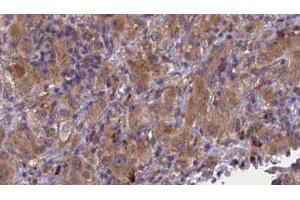 Immunohistochemistry (IHC) image for anti-Bone Morphogenetic Protein Receptor, Type IB (BMPR1B) (N-Term) antibody (ABIN6260292)