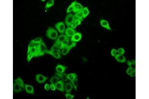 Detection of PKCi in MCF7 cells using Polyclonal Antibody to Protein Kinase C Iota (PKCi) (PKC iota 抗体  (AA 375-596))