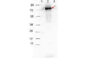 Western blot showing detection of 0. (Surface Lipoprotein P27 (BB_A60) 抗体)